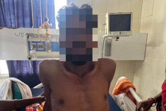 जिला चिकित्सालय बीजापुर में जटिल सर्जरी सफल, गंभीर अवस्था में भर्ती युवक को मिला नया जीवन
