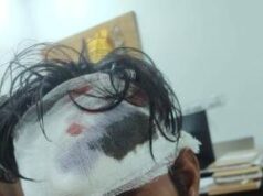 घरेलू विवाद : पिता ने बेटे पर किया जानलेवा हमला ! सिर और हाथ पर किया ताबड़तोड़ वार, अपराध दर्ज
