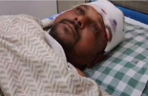 झगड़ा छुड़ाने बीच बचाव कर रहे पार्षद पर नशे में धुत युवक ने की मारपीट,आरोपी फरार